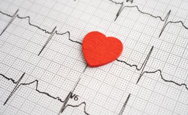 electrocardiogram