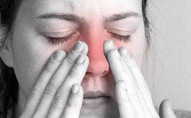 sinus polip