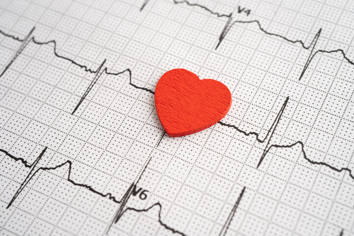 Tes EKG