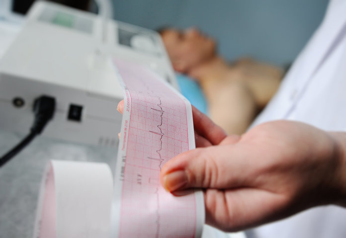 grafik EKG