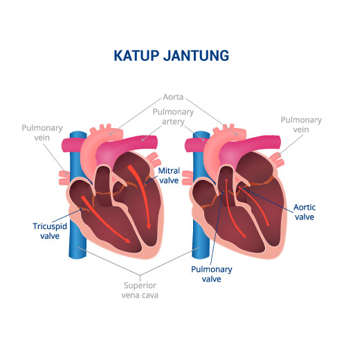 katup jantung