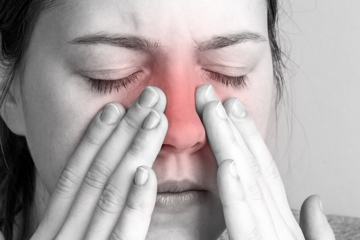 sinus polip