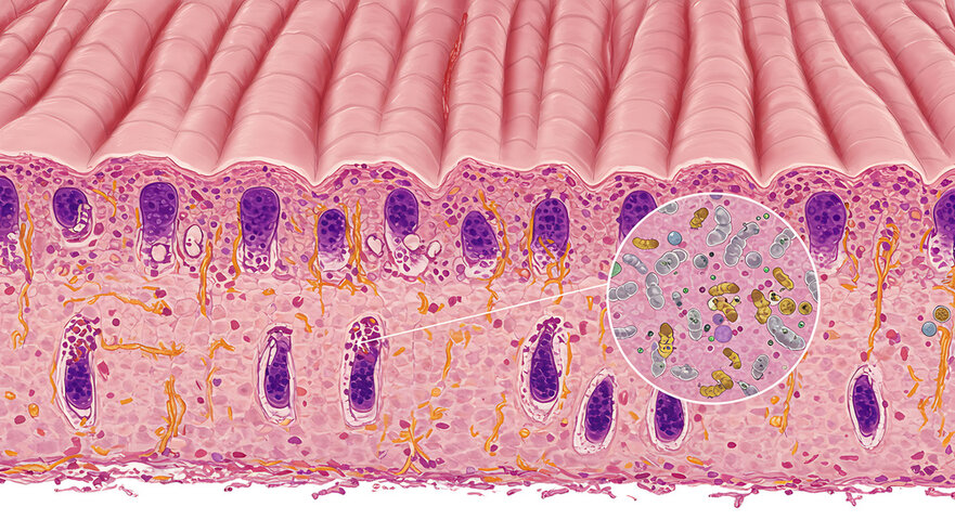 skin microbiome