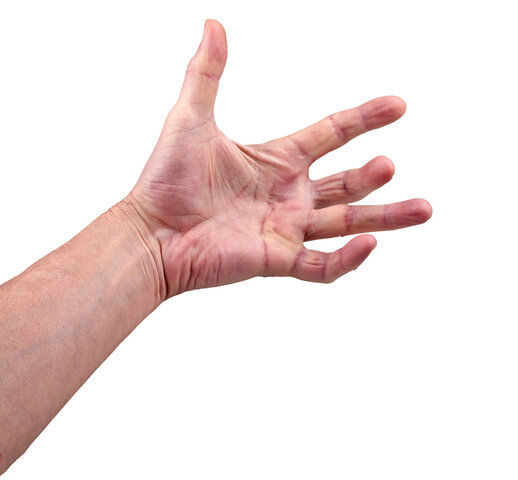 trigger finger