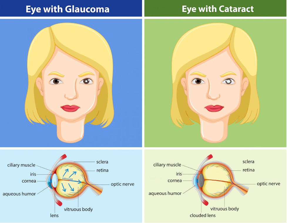 Retinopati Diabetik Premier Jatinegara Hospital